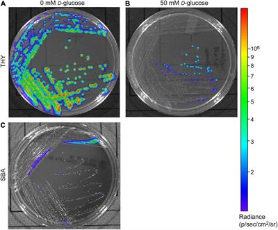 Sugar Shock: Probing Streptococcus pyogenes Metabolism Through Bioluminescence Imaging